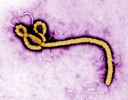 Sốt xuất huyết Ebola