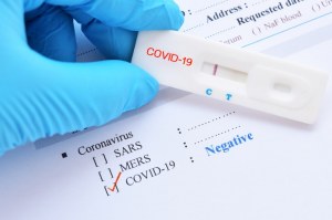 Nên sử dụng xét nghiệm nhanh dựa trên phát hiện kháng nguyên hay kháng thể COVID-19?